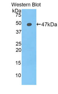 Polyclonal Antibody to Lipocalin 12 (LCN12)