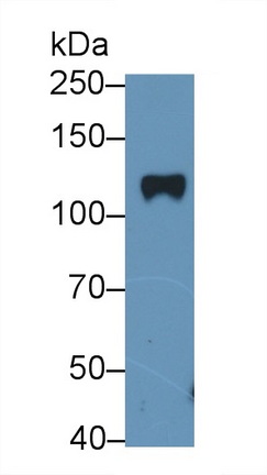 Polyclonal Antibody to Lipin 1 (LPIN1)