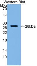 Polyclonal Antibody to Receptor Tyrosine Kinase Like Orphan Receptor 1 (ROR1)