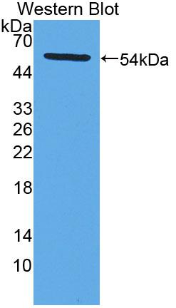 Polyclonal Antibody to Lysophosphatidylcholine Acyltransferase 1 (LPCAT1)