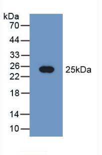 Polyclonal Antibody to Phosphatidylethanolamine Binding Protein 1 (PEBP1)