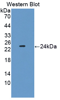 Polyclonal Antibody to Phosphatidylethanolamine Binding Protein 1 (PEBP1)