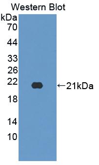 Polyclonal Antibody to Excitatory Amino Acid Transporter 4 (EAAT4)