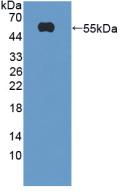 Polyclonal Antibody to Triggering Receptor Expressed On Myeloid Cells 2 (TREM2)