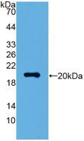 Polyclonal Antibody to Visinin Like Protein 1 (VSNL1)