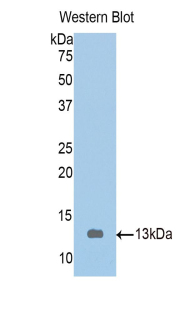 Polyclonal Antibody to Tropomodulin 1 (TMOD1)