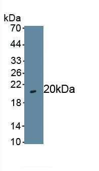 Polyclonal Antibody to GA Binding Protein Transcription Factor Alpha (GABPa)