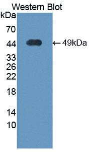 Polyclonal Antibody to Transcobalamin II, Macrocytic Anemia (TCN2)