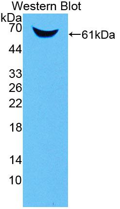 Polyclonal Antibody to Ankyrin Repeat Domain Protein 1 (ANKRD1)