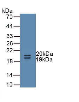 Polyclonal Antibody to Uromodulin (UMOD)