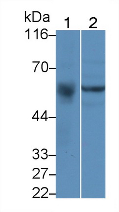 Polyclonal Antibody to UDP Glucuronosyltransferase 2 Family, Polypeptide B7 (UGT2B7)