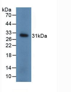 Polyclonal Antibody to Ubiquitin Carboxyl Terminal Hydrolase L1 (UCHL1)