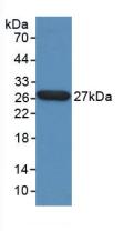 Polyclonal Antibody to Tumor Protein, Translationally Controlled 1 (TPT1)