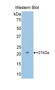 Polyclonal Antibody to Tumor Protein, Translationally Controlled 1 (TPT1)