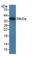 Polyclonal Antibody to Toll Like Receptor Adaptor Molecule 1 (TICAM1)