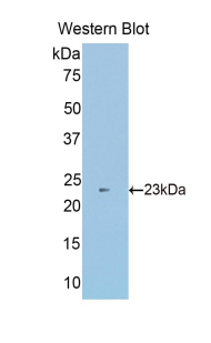 Polyclonal Antibody to Sulfite Oxidase (SUOX)