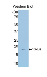 Polyclonal Antibody to Sulfite Oxidase (SUOX)