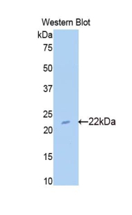 Polyclonal Antibody to Sulfite Oxidase (SUOX)