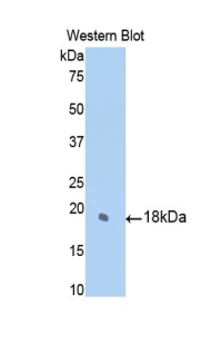 Polyclonal Antibody to Sulfite Oxidase (SUOX)