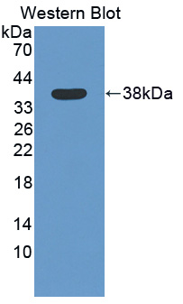 Polyclonal Antibody to Signal Transducing Adaptor Protein 1 (STAP1)