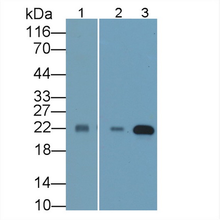 Polyclonal Antibody to Sorcin (SRI)