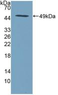 Polyclonal Antibody to Serine Peptidase Inhibitor Kunitz Type 2 (SPINT2)