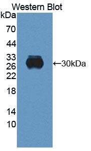 Polyclonal Antibody to Retbindin (RTBDN)