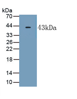 Polyclonal Antibody to Receptor Activity Modifying Protein 2 (RAMP2)