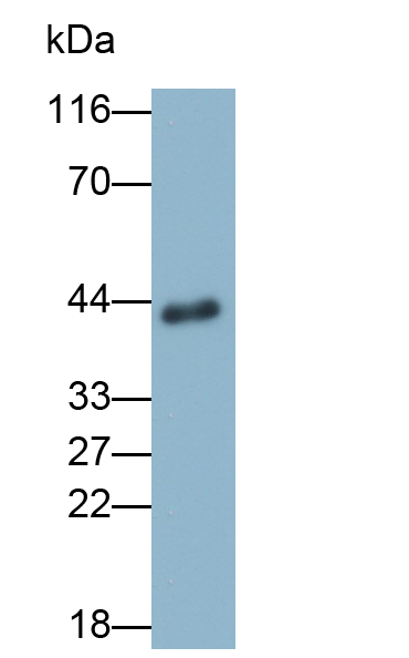 Polyclonal Antibody to Glutaminyl Peptide Cyclotransferase (QPCT)
