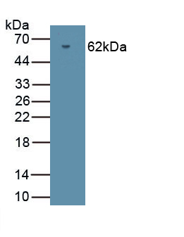 Polyclonal Antibody to Protein Kinase, cGMP Dependent Type II (PRKG2)