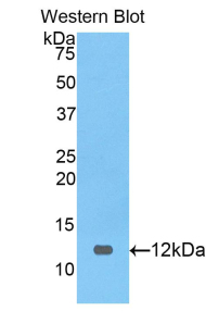 Polyclonal Antibody to Preferentially Expressed Antigen In Melanoma (PRAME)