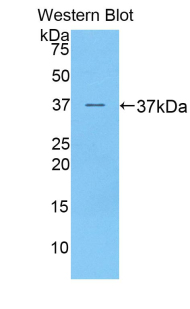 Polyclonal Antibody to Preferentially Expressed Antigen In Melanoma (PRAME)