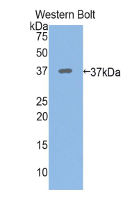 Polyclonal Antibody to Periplakin (PPL)