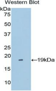 Polyclonal Antibody to Periostin (POSTN)