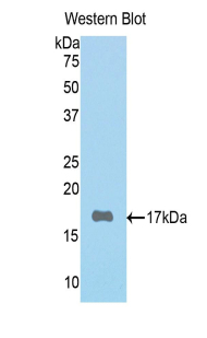 Polyclonal Antibody to Periostin (POSTN)