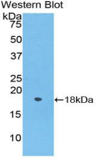 Polyclonal Antibody to Periostin (POSTN)