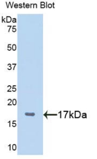 Polyclonal Antibody to Pleiomorphic Adenoma Gene Like Protein 1 (PLAGL1)