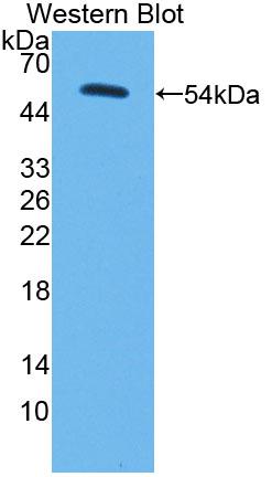 Polyclonal Antibody to Pyruvate Carboxylase (PC)