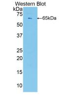 Polyclonal Antibody to Polybromo 1 (PBRM1)