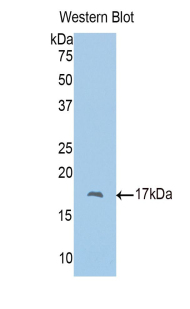 Polyclonal Antibody to Polybromo 1 (PBRM1)