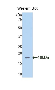 Polyclonal Antibody to Polybromo 1 (PBRM1)