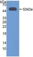 Polyclonal Antibody to 3-Oxoacid Coenzyme A Transferase 1 (OXCT1)