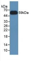 Polyclonal Antibody to Nicotinamide-N-Methyltransferase (NNMT)