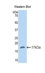 Polyclonal Antibody to Nicotinamide-N-Methyltransferase (NNMT)