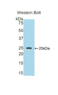 Polyclonal Antibody to Nexilin (NEXN)