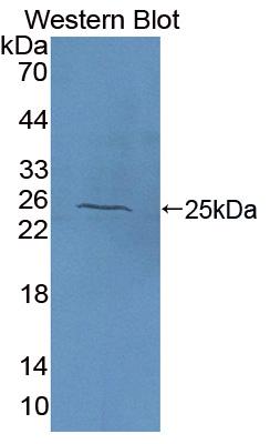 Polyclonal Antibody to N-Acetylgalactosaminidase Alpha (NAGa)