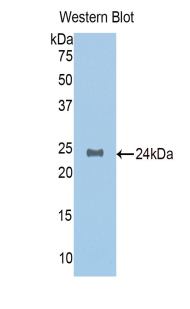 Polyclonal Antibody to N-Acetylgalactosaminidase Alpha (NAGa)