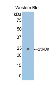 Polyclonal Antibody to N-Acetylgalactosaminidase Alpha (NAGa)