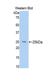 Polyclonal Antibody to N-Acetylgalactosaminidase Alpha (NAGa)