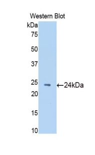 Polyclonal Antibody to N-Acetylgalactosaminidase Alpha (NAGa)